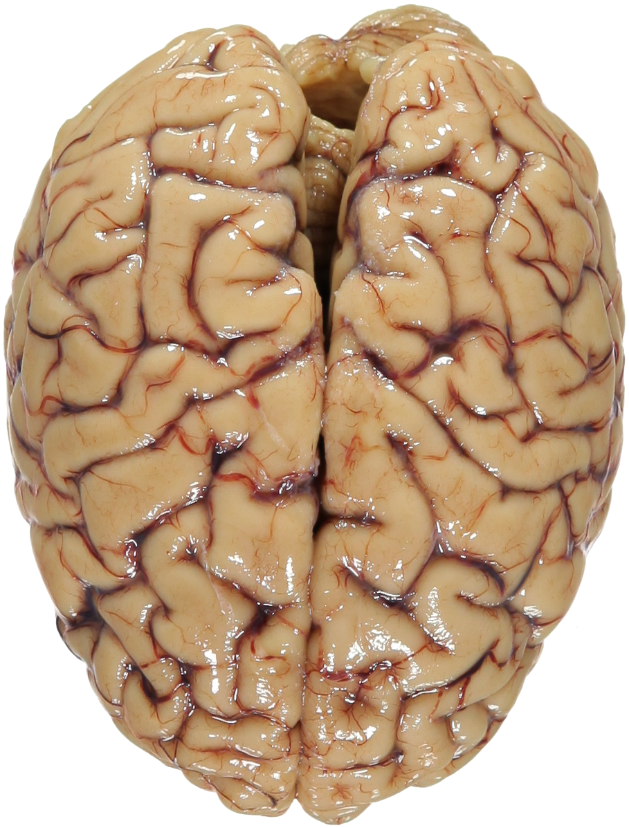 Imagen Transparente del cerebro humano