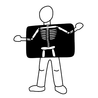 X-Ray PNG Download Image