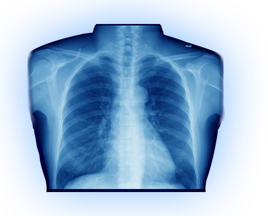 X-Ray PNG Free Download