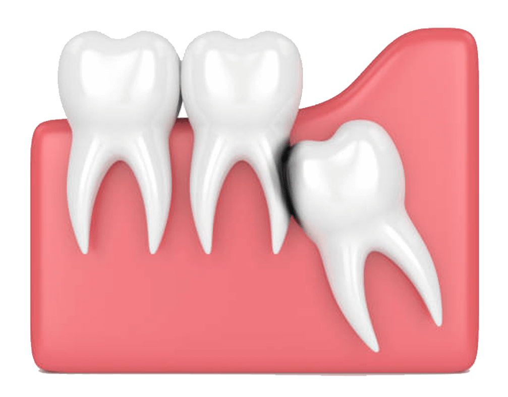 Email Image PNG de dents