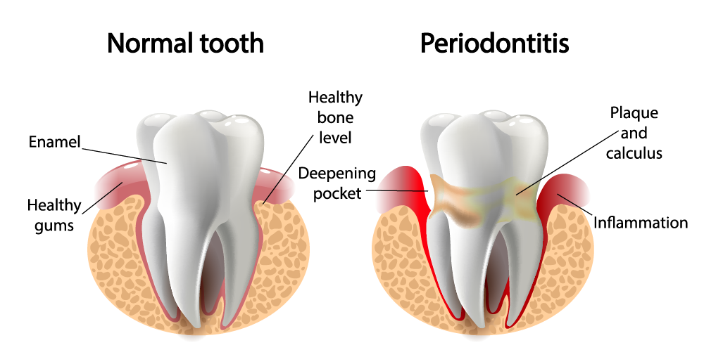 Imagem de alta qualidade do PNG do dente saudável