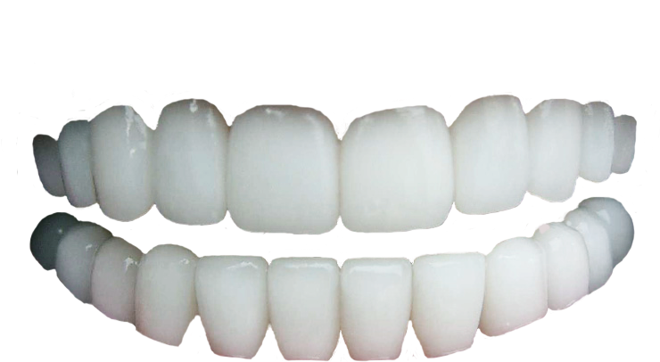 Imagen Transparente del diente humano