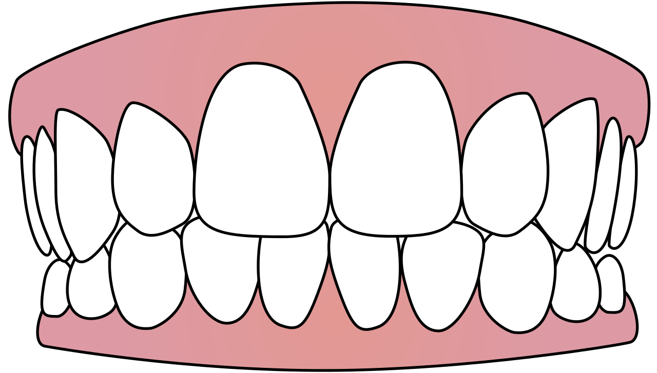 Immagine del PNG del dente bianco
