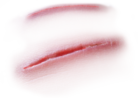 Immagine della cicatrice PNG