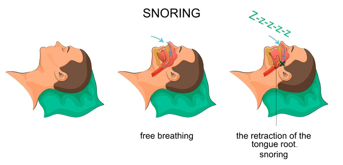 Snoring PNG Pic