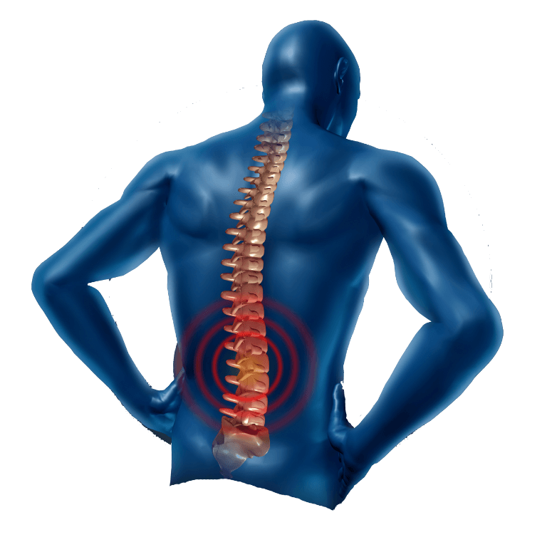 Back Pain PNG Pic