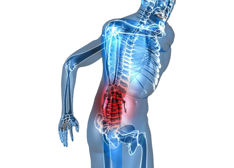 Lower Back Pain Png Image Png Arts