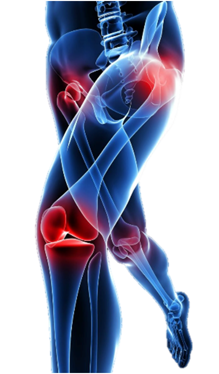 Musculoskeletal Back Pain PNG Image Background