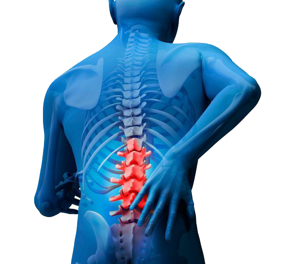 Musculoskeletal Back Pain PNG Photo